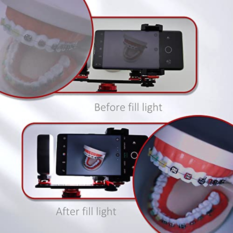 Bluetooth Dental Flash Light P - مراجعة Photography Lighting With Flash وسعره