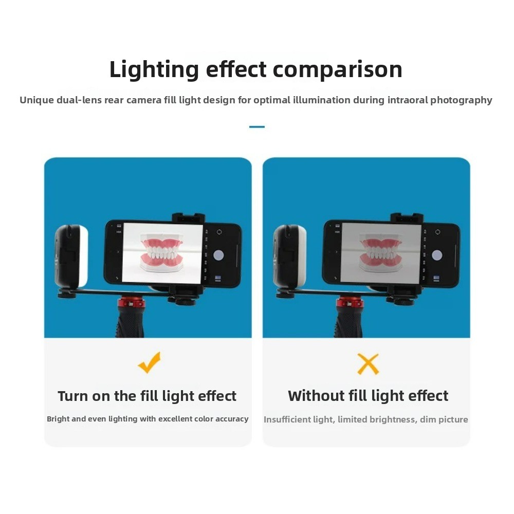 Dental Photography Light, Blue - مراجعة Photography Lighting With Flash وسعره