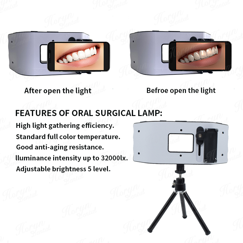 Dental Flash Light Photography - مراجعة Photography Lighting With Flash وسعره